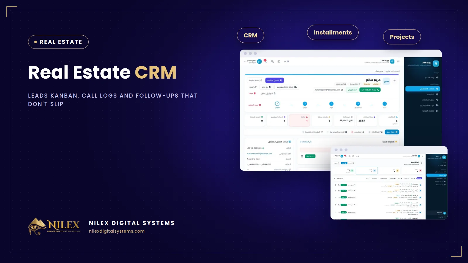 Real estate CRM kanban board with leads by stage, call log and follow-ups queue